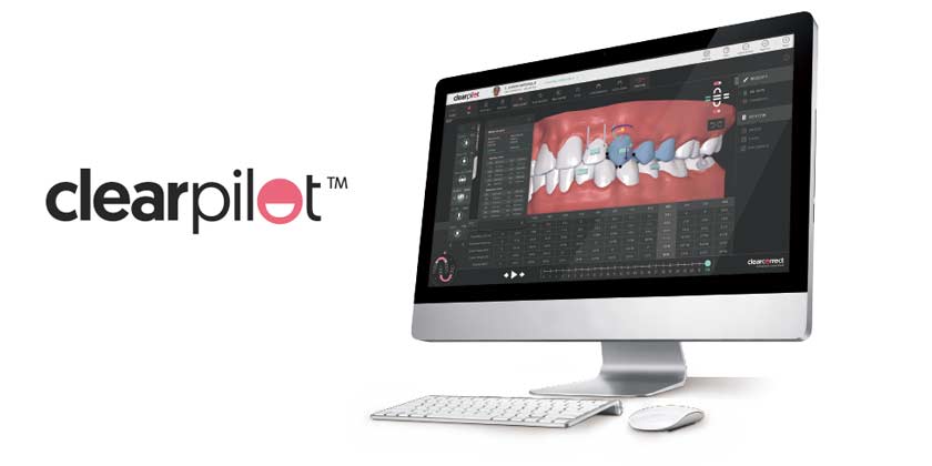 Advertorial: ClearPilot 5.0