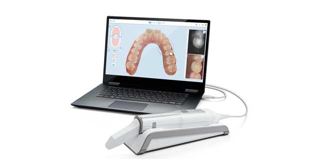 Align Technology: Innovation and Passion