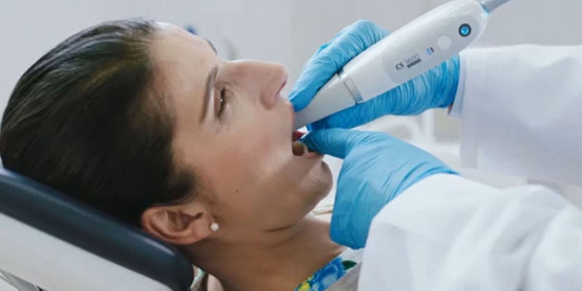 CS 3700: “Turbo” Speed Intraoral Scanning